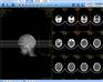 CT工作站、CT/MR影像工作站软件 DICOM数字型