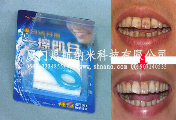 烟牙克星美白洁牙擦快速清洁美白牙齿