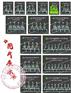 供應汕頭SLP1650平行反應釜，汕頭多位平行反應器